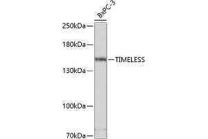 Western blot analysis of extracts of BxPC-3 cells, using TIMELESS antibody (ABIN1683038, ABIN3018743, ABIN3018744 and ABIN6220565) at 1:3000 dilution. (TIMELESS anticorps  (AA 969-1208))
