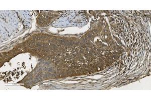 IHC analysis of MPI using anti-MPI antibody (ABIN7600514). (MPI anticorps  (AA 2-99))