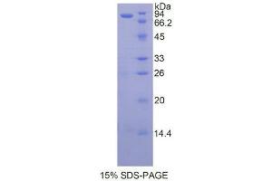 SDS-PAGE analysis of Human HSP90aB1 Protein. (Heat Shock Protein 90kDa alpha B1 Protéine)