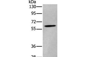 Western blot analysis of Human cerebrum tissue lysate using ZKSCAN1 Polyclonal Antibody at dilution of 1:400 (ZKSCAN1 anticorps)