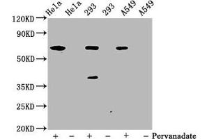 Western Blot Positive WB detected in Hela whole cell lysate ?