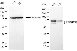 Western blotting analysis using PPP2R5D antibody (ABIN7800023).