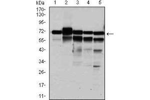 Western blot analysis using RPA1 mouse mAb against HeLa (1), MCF-7 (2), K562(3), A431(4), and COS-7 (6) cell lysate. (RPA1 anticorps)
