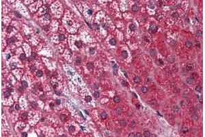 Human Adrenal: Formalin-Fixed, Paraffin-Embedded (FFPE)