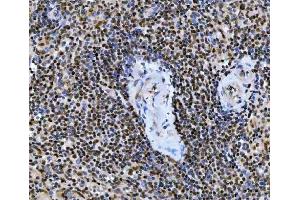 IHC analysis of UBC12/UBE2M using anti-UBC12/UBE2M antibody (ABIN7600885). (UBE2M anticorps  (AA 25-154))