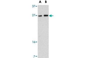 Western blot analysis of TMEM18 in rat brain tissue lysate with TMEM18 polyclonal antibody  at (A) 0. (Transmembrane Protein 18 (TMM18) (C-Term) anticorps)
