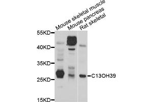 Western blot analysis of extracts of various cell lines, using METTL21C antibody (ABIN5998216) at 1/1000 dilution. (METTL21C anticorps)