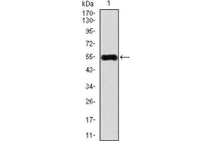 Western Blotting (WB) image for anti-Calcium/calmodulin-Dependent Protein Kinase IV (CAMK4) (AA 35-292) antibody (ABIN1845379)