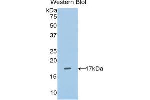 Western blot analysis of the recombinant protein. (SLC3A2 anticorps  (AA 270-406))