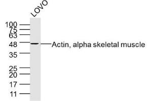 LoVo lysates probed with Actin, alpha skeletal muscle Polyclonal Antibody, Unconjugated  at 1:300 dilution and 4˚C overnight incubation.
