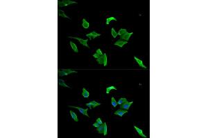 Immunofluorescence (IF) image for anti-Lymphocyte Cytosolic Protein 1 (LCP1) antibody (ABIN1876741) (LCP1 anticorps)