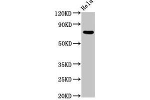Western Blot Positive WB detected in: Hela whole cell lysate All lanes: MTMR2 antibody at 5. (MTMR2 anticorps  (AA 1-173))