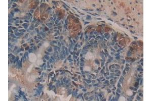DAB staining on IHC-P; Samples: Mouse Small intestine Tissue