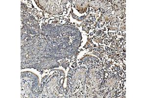 IHC analysis of Prohibitin/PHB using anti-Prohibitin/PHB antibody (ABIN7599170). (Prohibitin anticorps  (AA 1-257))