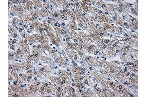 Immunohistochemical staining of paraffin-embedded liver tissue using anti-ATP5B mouse monoclonal antibody. (ATP5B anticorps)