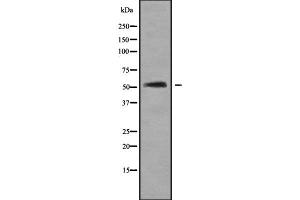 Western blot analysis of BAGE5 using HeLa whole cell lysates (BAGE5 anticorps)
