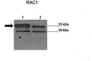 Sample Type: Lane 1:241 µg siRUVBL1 transfected human H1299 cells Lane 2: 041 µg untransfected human H1299 cells Primary Antibody Dilution: 1:0000Secondary Antibody: Anti-rabbit-HRP Secondary Antibody Dilution: 1:0000 Color/Signal Descriptions: RAC1  Gene Name: Wenwei Hu, Xuetian Yue, Rutgers Cancer Institute of New Jersey.