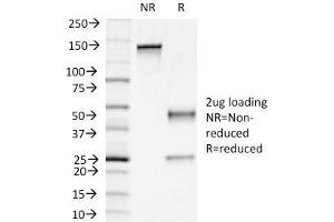 SDS-PAGE Analysis Purified Napsin A Mouse Monoclonal Antibody (NAPSA/1239). (NAPSA anticorps  (AA 189-299))