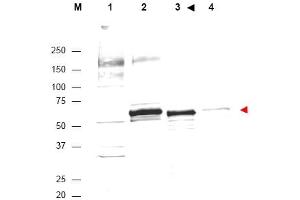 Image no. 1 for anti-V-Akt Murine Thymoma Viral Oncogene Homolog 1 (AKT1) (Internal Region) antibody (ABIN401484) (AKT1 anticorps  (Internal Region))