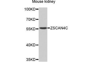 Western blot analysis of extracts of mouse kidney, using ZSCAN4 antibody. (ZSCAN4 anticorps)