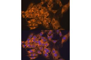 Immunofluorescence analysis of C6 cells using RPL17 antibody (ABIN6128342, ABIN6147115, ABIN6147116 and ABIN6221632) at dilution of 1:100.