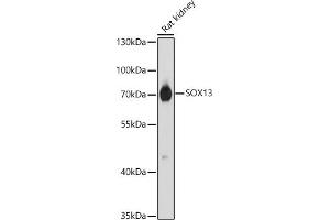 Western blot analysis of extracts of Rat kidney, using SOX13 antibody (ABIN7270570) at 1:1000 dilution. (SOX13 anticorps  (AA 1-180))