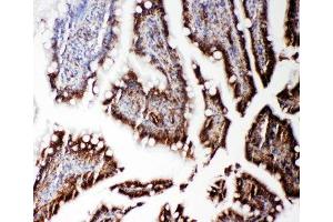 IHC-P: RGS3 antibody testing of rat intestine tissue (RGS3 anticorps  (C-Term))