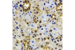 Immunohistochemical analysis of ADH4 staining in rat kidney formalin fixed paraffin embedded tissue section. (ADH4 anticorps)