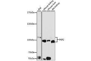 Western blot analysis of extracts of various cell lines, using PKP2 antibody (ABIN1876693) at 1:1000 dilution.