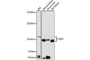 Western blot analysis of extracts of various cell lines, using PKP2 antibody (ABIN1876693) at 1:1000 dilution. (Plakophilin 2 anticorps)