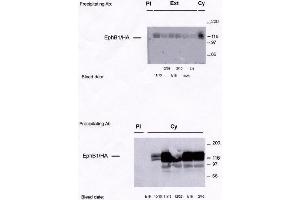 Image no. 1 for anti-EPH Receptor B1 (EPHB1) antibody (ABIN264959) (EPH Receptor B1 anticorps)