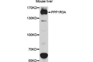 Western blot analysis of extracts of mouse liver, using PPP1R3A antibody (ABIN6003865) at 1/1000 dilution. (PPP1R3A anticorps)