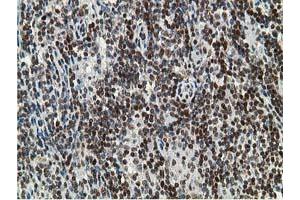 Image no. 6 for anti-Deoxycytidine Kinase (DCK) antibody (ABIN1497775)