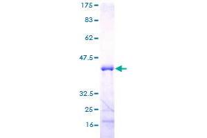 Image no. 1 for Mediator Complex Subunit 21 (MED21) (AA 1-144) protein (GST tag) (ABIN1310649)