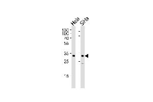Western blot analysis of lysates from Hela, SiHa cell line (from left to right), using SNAI1 Antibody (N-term R8) (ABIN388812 and ABIN2839130). (SNAIL anticorps  (N-Term))