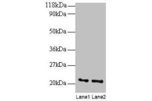 Western blot All lanes: ARF4 antibody at 2 μg/mL Lane 1: EC109 whole cell lysate Lane 2: 293T whole cell lysate Secondary Goat polyclonal to rabbit IgG at 1/15000 dilution Predicted band size: 21 kDa Observed band size: 21 kDa (ARF4 anticorps  (AA 1-180))