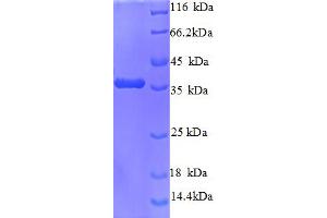 SDS-PAGE (SDS) image for Cyclin-Dependent Kinase 4 (CDK4) (AA 2-303) protein (His tag) (ABIN5712788) (CDK4 Protein (AA 2-303) (His tag))