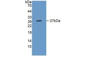 Detection of Recombinant GluAP, Human using Polyclonal Antibody to Aminopeptidase A (ENPEP)