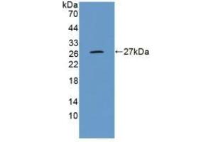 Detection of Recombinant GluAP, Human using Polyclonal Antibody to Aminopeptidase A (ENPEP) (ENPEP anticorps  (AA 718-948))