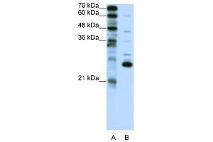 RCV1 antibody used at 2. (Recoverin anticorps  (C-Term))