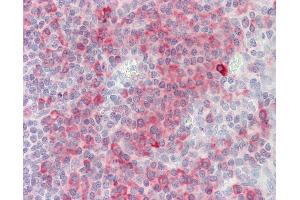 Anti-SH2D1A / SAP antibody IHC staining of human tonsil.