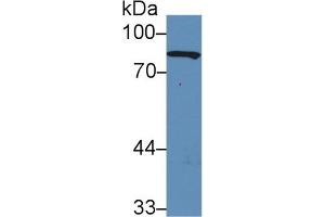 Western Blot; Sample: Rat Serum; ;Primary Ab: 5µg/ml Rabbit Anti-Rat GS Antibody;Second Ab: 0. (Gelsolin anticorps  (AA 432-780))
