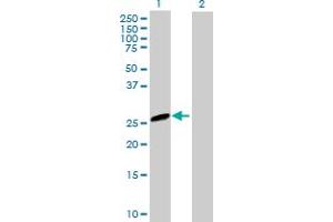Western Blot analysis of EVI2A expression in transfected 293T cell line by EVI2A MaxPab polyclonal antibody. (EVI2A anticorps  (AA 25-236))