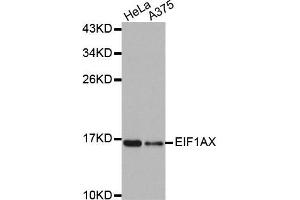 Western Blotting (WB) image for anti-Eukaryotic Translation Initiation Factor 1A, X-Linked (EIF1AX) antibody (ABIN1876946) (EIF1AX anticorps)