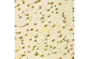 Immunohistochemistry of paraffin-embedded rat brain using HDGF Antibody. (HDGF anticorps  (AA 1-240))
