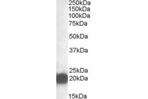 Western Blotting (WB) image for anti-Cysteine and Glycine-Rich Protein 3 (CSRP3) (Internal Region) antibody (ABIN2466624) (CSRP3 anticorps  (Internal Region))