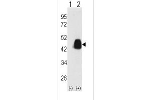 Western blot analysis of PDX1 (arrow) using PDX1 Antibody (T11) (ABIN388774 and ABIN2839109).