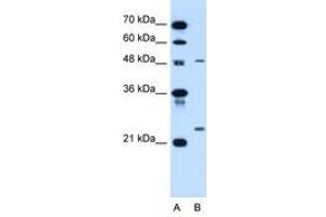 Image no. 1 for anti-Sphingomyelin phosphodiesterase 2, Neutral Membrane (Neutral Sphingomyelinase) (SMPD2) (AA 60-109) antibody (ABIN205079) (SMPD2 anticorps  (AA 60-109))