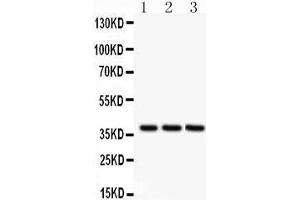 Anti-Bonzo antibody, Western blotting All lanes: Anti Bonzo  at 0. (CXCR6 anticorps  (C-Term))