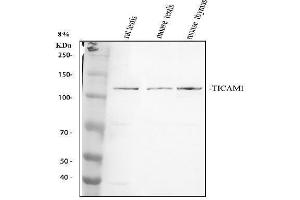 Western blot analysis of TRIF/TICAM1 using anti-TRIF/TICAM1 antibody (ABIN3043539).